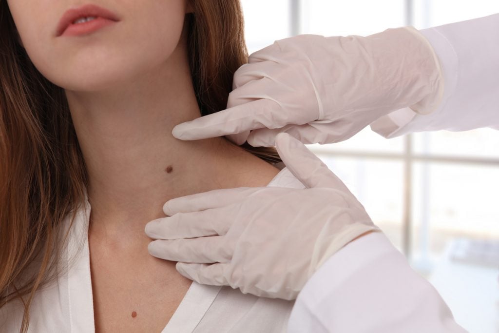 Médico examinando a pinta no pescoço de uma mulher