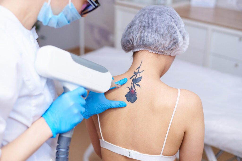 Mulher sentada com médico fazendo remoção de tatuagem