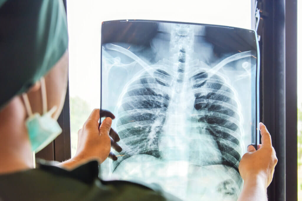 Médica olhando o raio-X de um pulmão