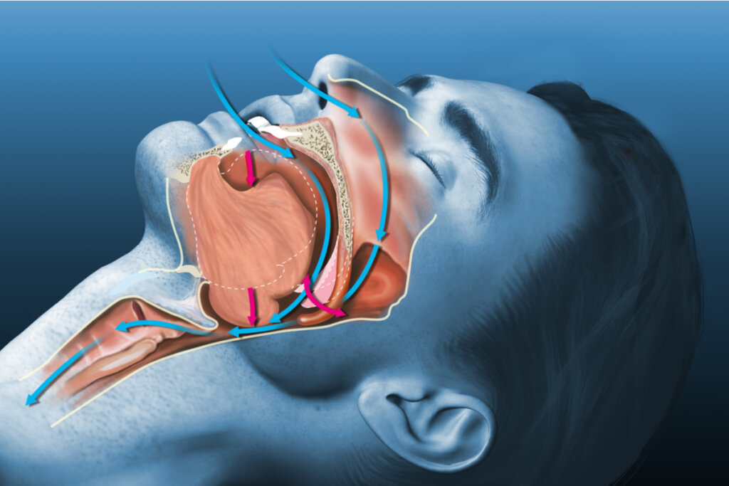 Ilustração anatómica de uma mulher dormindo respirando pela boca