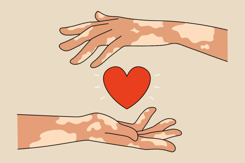 Ilustração de duas mãos com manchas claras em volta de coração