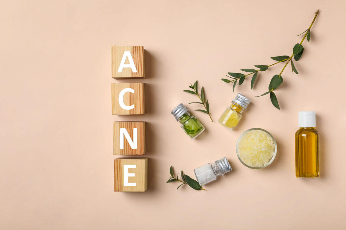 7 dicas para combater a acne resistente