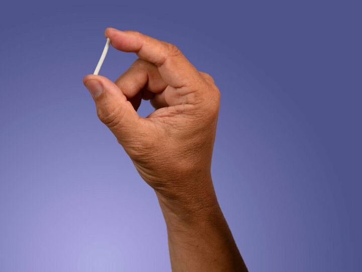 8 coisas que você precisa saber sobre o implante anticoncepcional