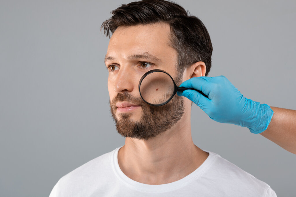 Médico examinando pinta no rosto de um homem
