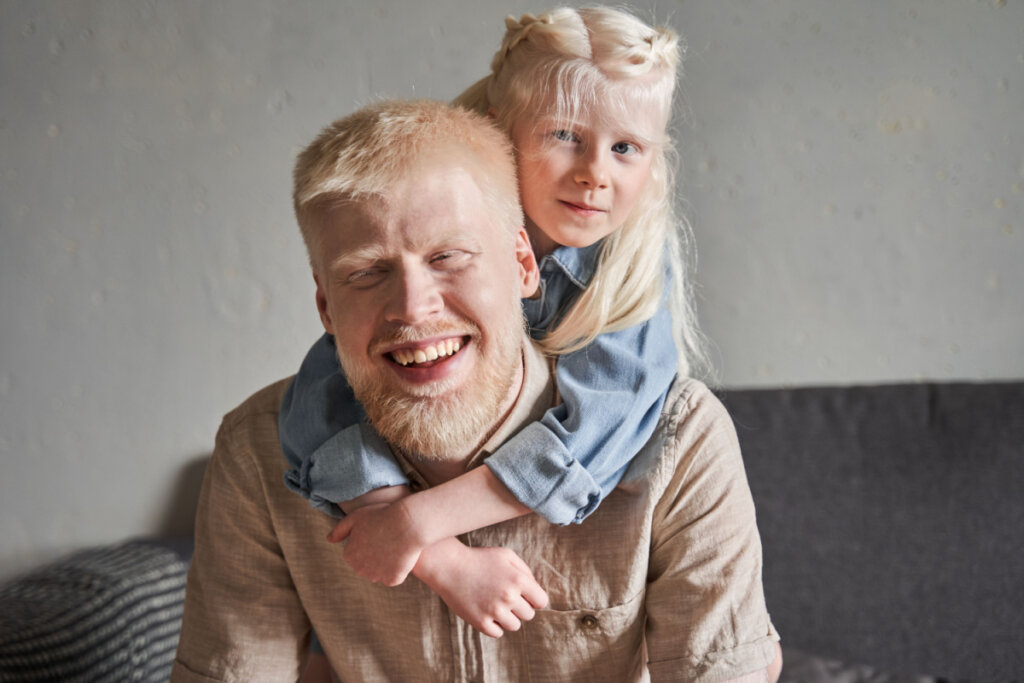 Pai e filha albinos abraçados e rindo.