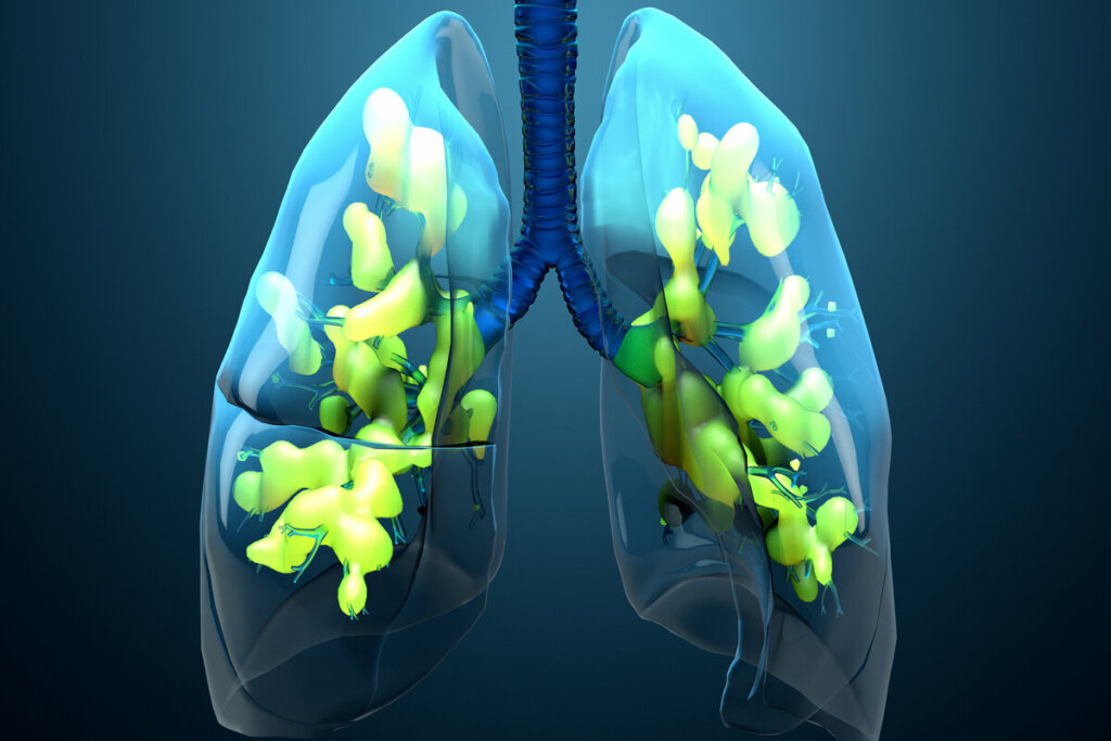 Ilustração do vírus da sepse no pulmão