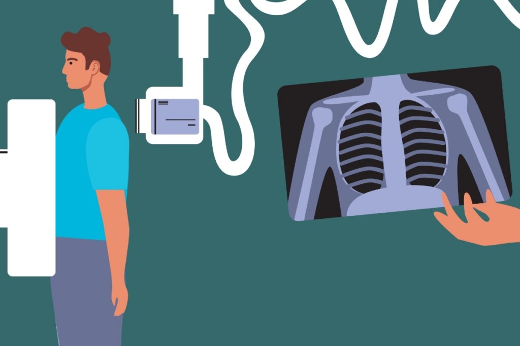 Ilustração de um homem fazendo tomografia no tórax 