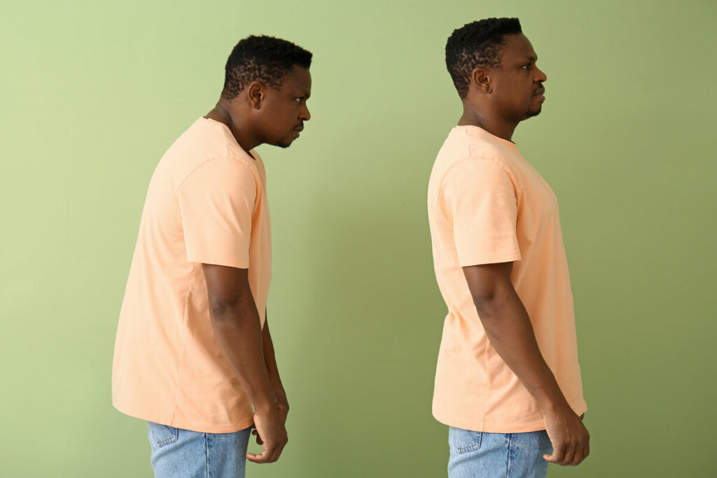 Duas imagens de um homem em pé com a coluna sem postura e a outra com a coluna em posição correta 