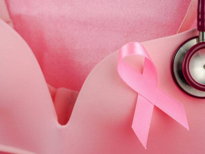 Implante de silicone e câncer de mama: o que você precisa saber