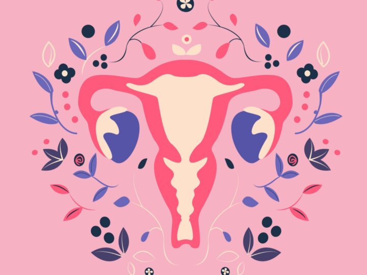 4 tipos de tratamento para a endometriose
