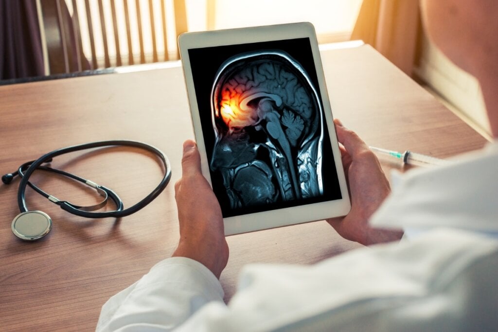 Mãos masculina segurando um tablet com exame de um cérebro