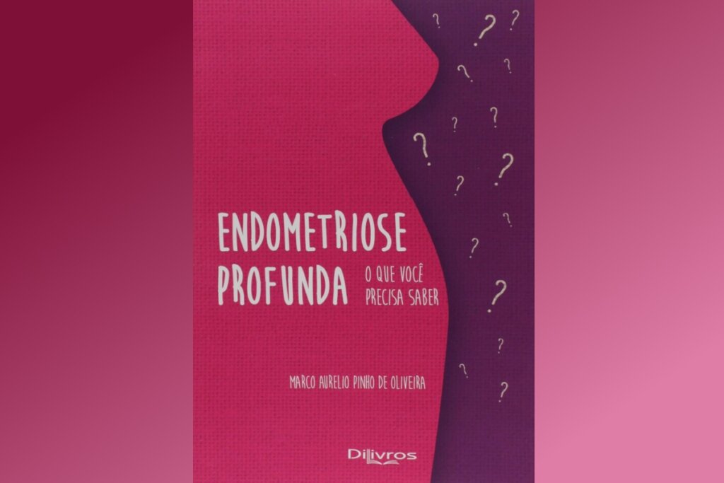 Capa do livro "Endometriose profunda: o que você precisa saber"