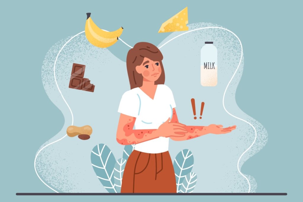 Ilustração de mulher com reação alérgica nos bralos e alimentos que causam alergia alimentar em volta