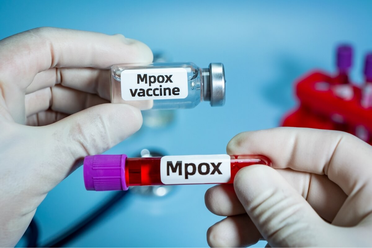 8 perguntas e respostas sobre a Mpox