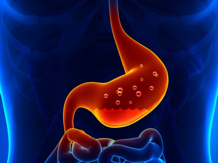 Entenda a relação entre carboidratos e refluxo