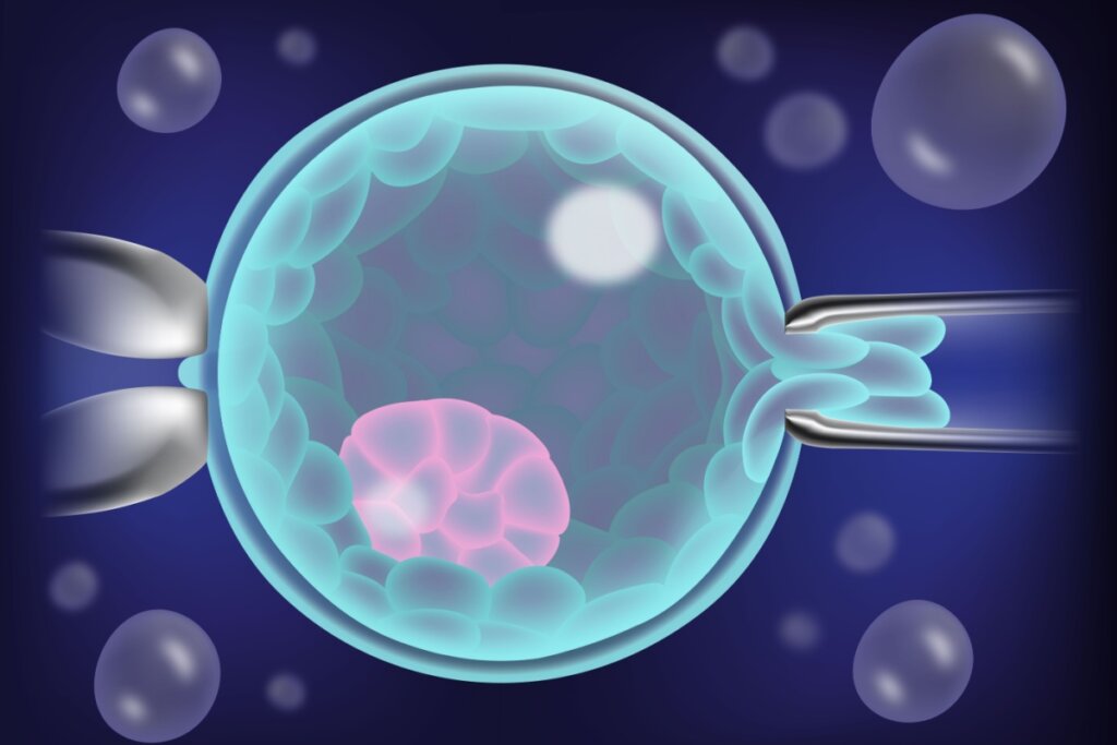 ilustração de biópsia embrionária após fertilização in vitro ou ICSI para triagem genética pré-implantação