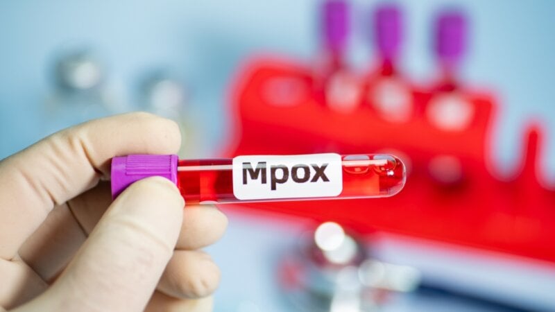 Veja os sintomas e as formas de prevenção contra a mpox