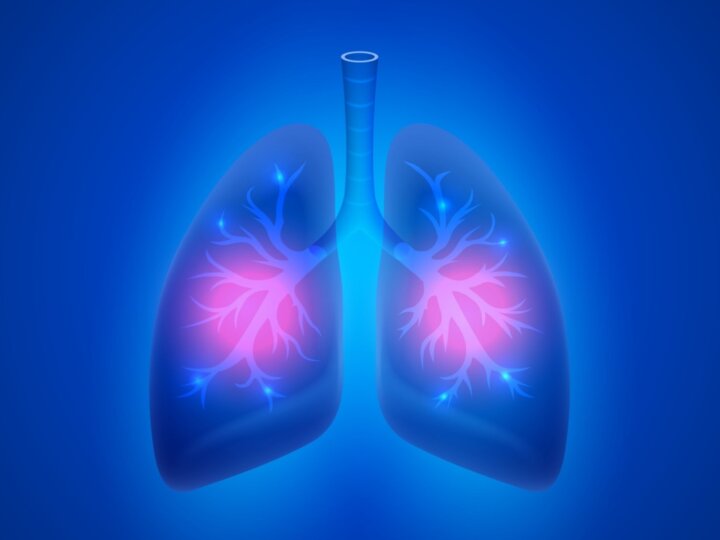 Conheça os sintomas da pneumonia e saiba como tratar