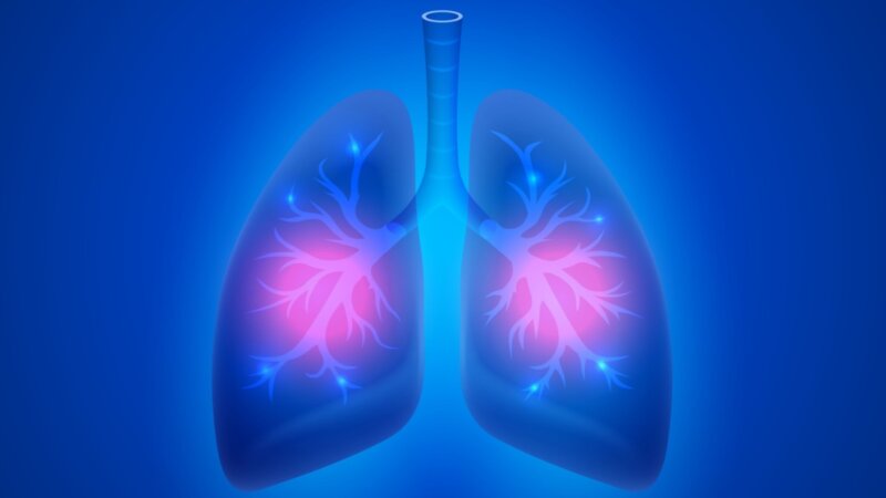 Conheça os sintomas da pneumonia e saiba como tratar