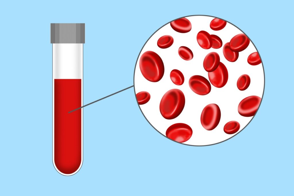 Tudo de sangue, com parte do sangue sendo analisado